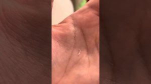 #Острицы. #Глисты. #Паразиты. #Личинки остриц. #Размножение остриц