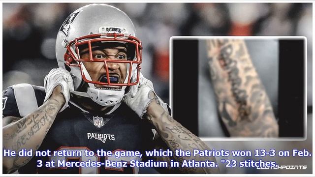 Patriots' Patrick Chung shows off scar from Super Bowl injury смотреть онлайн