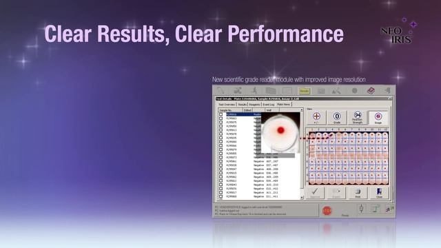 NEO Iris: Immucor’s next generation high throughput blood bank automation смотреть онлайн