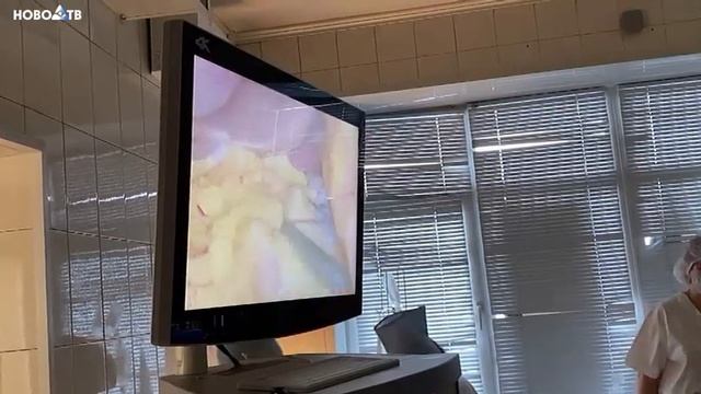 Онкологи Кузбасса увеличили количество эндоскопических операций в 1,5 раза смотреть онлайн
