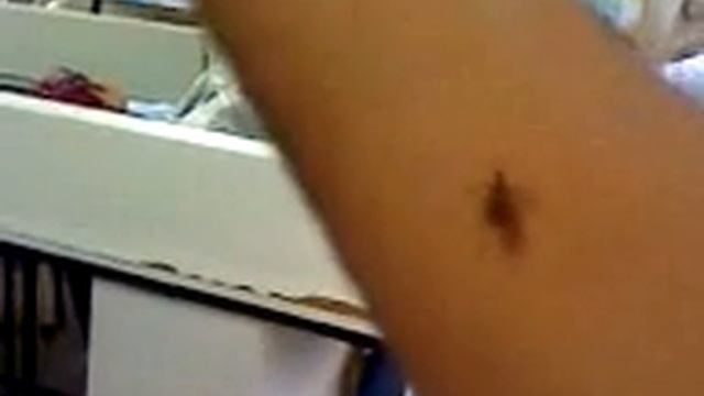 Aula prática Parasitologia Médica UFMG - Barbeiro (Rhodnius sp) смотреть онлайн