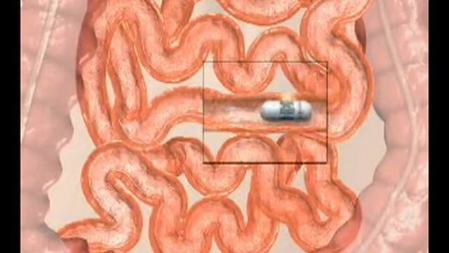 Sayaka: Next-generation Capsule Endoscope