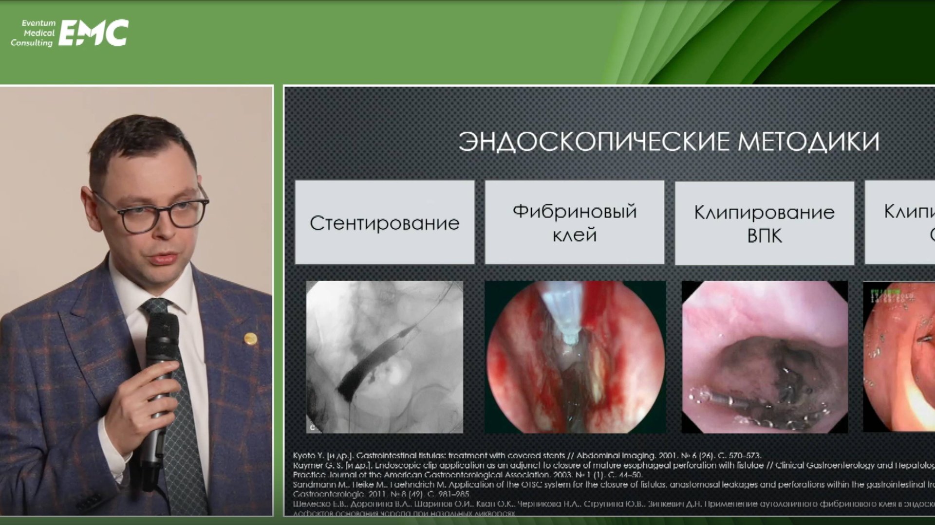 4. Ликутов А.А. Первый опыт ликвидации толстокишечных свищей, осложняющих дивертикулярную болезнь.