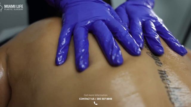 Beneficios De Los Masajes Post Operacion - La Damosky - MiamiLife Plastic Surgery