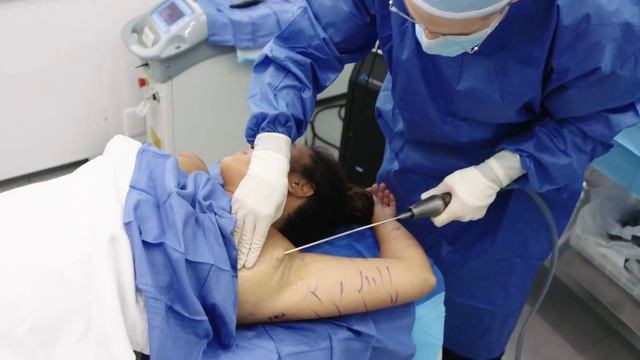 This $5,000 Laser Removes Fat From Your Armpit | The Plastics | Harper's BAZAAR смотреть онлайн