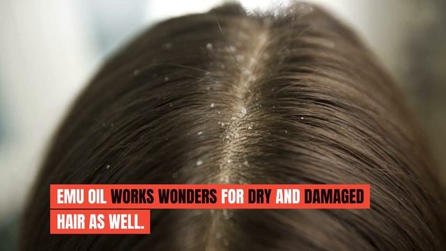 The Ultimate Guide to Emu Oil: A Natural Wonder for Skin and Hair смотреть онлайн