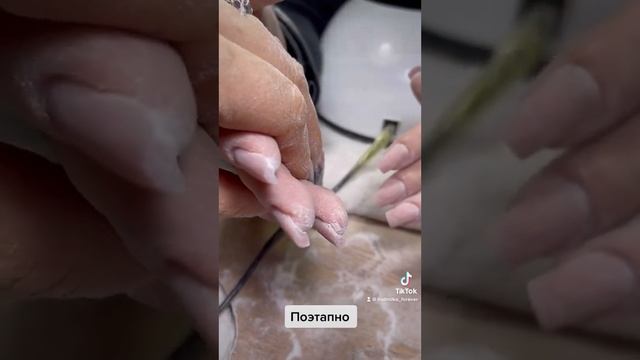 Калужница над ногтями которые клюют смотреть онлайн