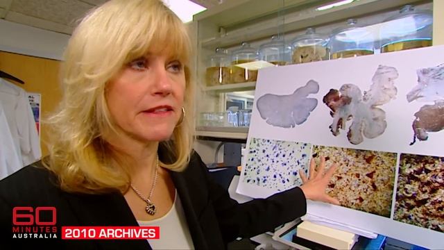 Dissecting an athlete's brain to determine the real impact of contact sports | 60 Minutes Australia смотреть онлайн