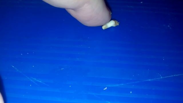 Дело про капусту с костями смотреть онлайн