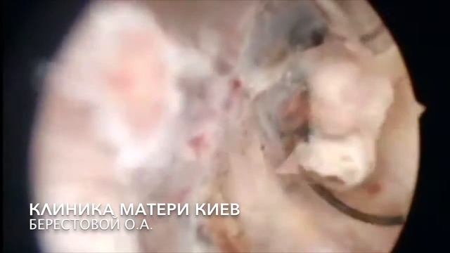 21+ Жесть, Нитки в матке, о какой беременности мы говорим? Ужас смотреть онлайн