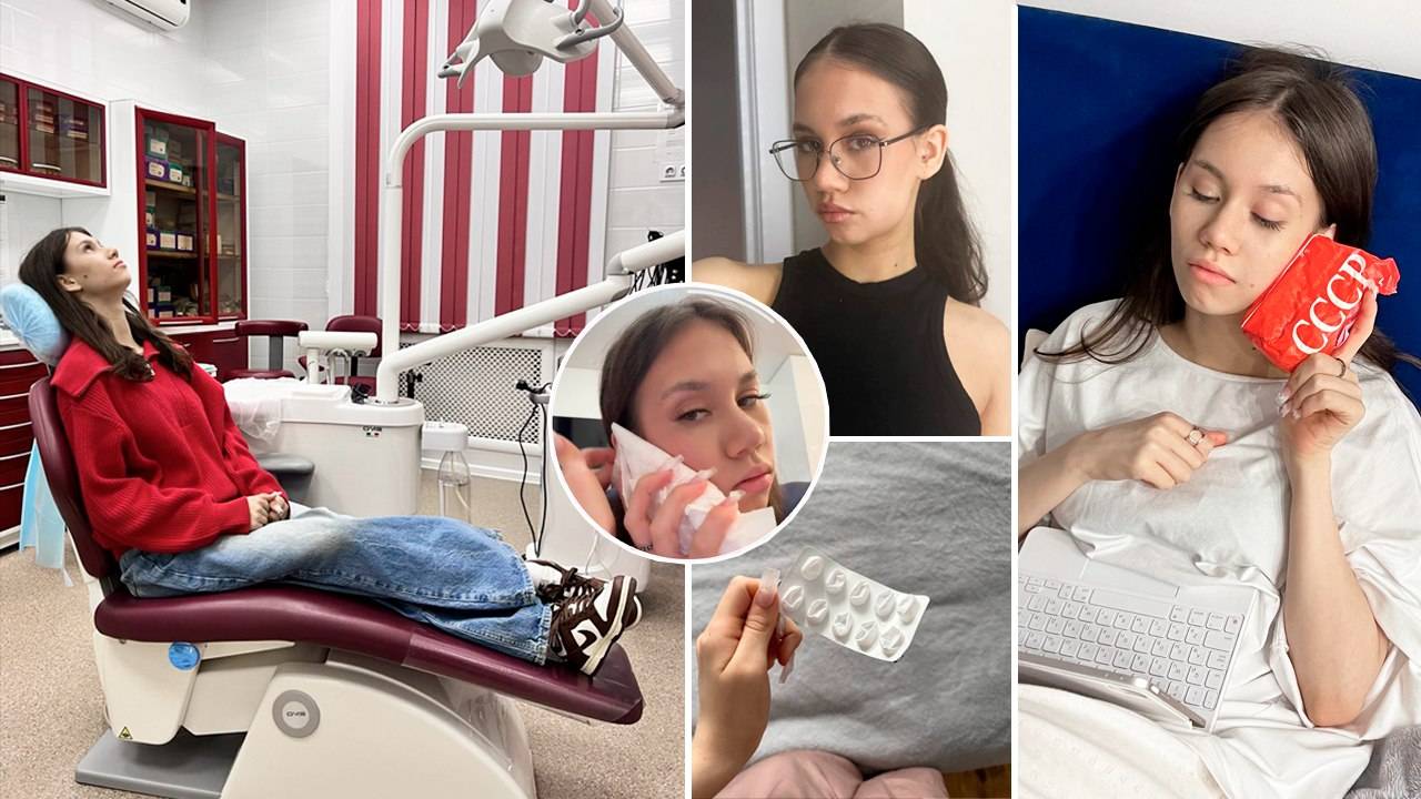 СНИМАЮ свой ДЕНЬ после УДАЛЕНИЯ ЗУБА 🦷 перед ПОЕЗДКОЙ с КЛАССОМ 🥳 смотреть онлайн