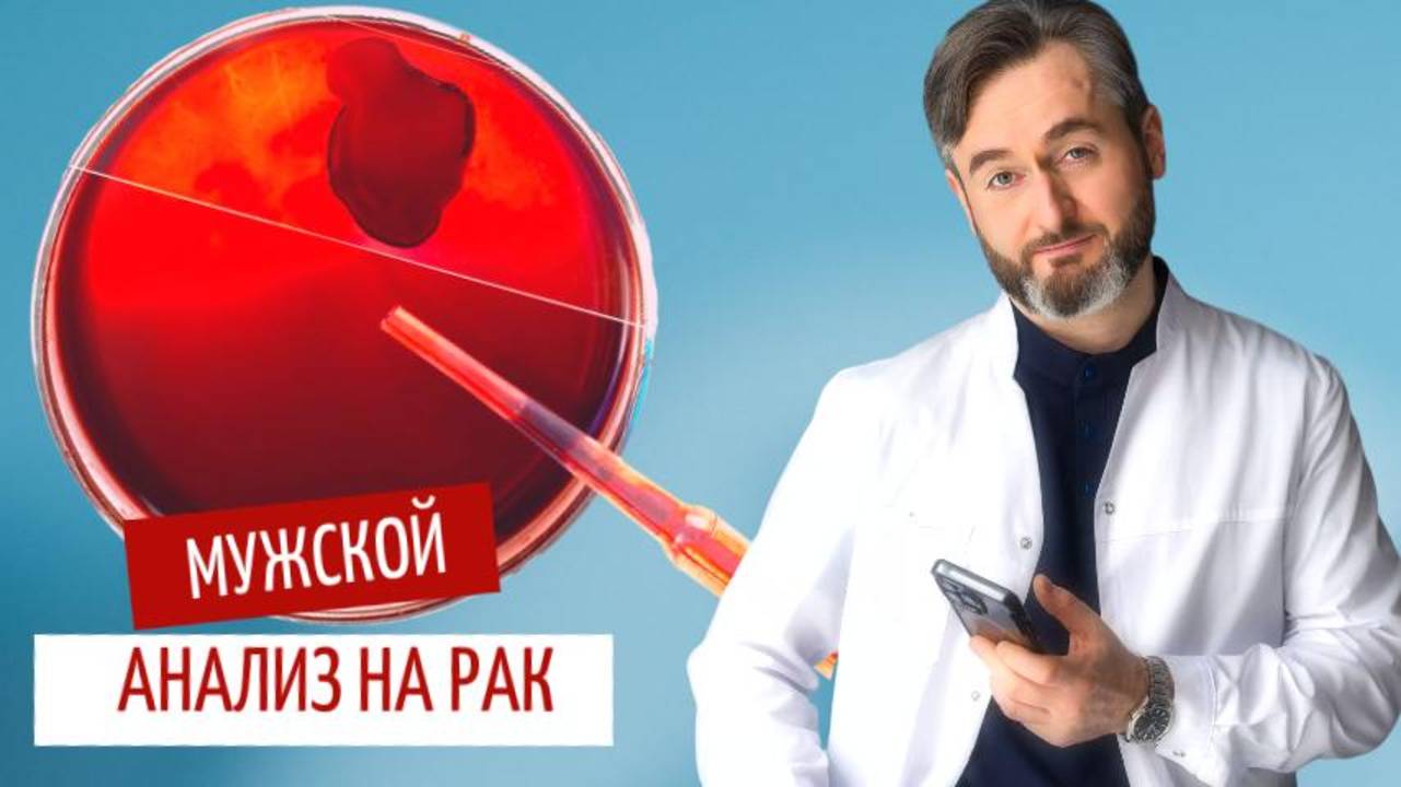 Что нужно знать о раке предстательной железы каждому мужчине