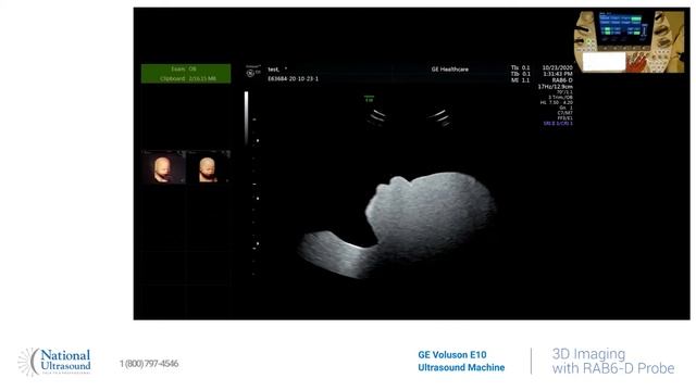 GE Voluson E10 3D Imaging Training Video Demonstration смотреть онлайн