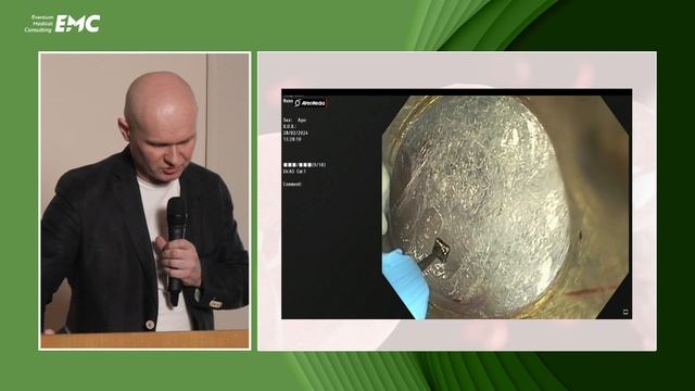 6. Шаповалов А.В, Вакурова Е.С Способы эндоскопического лечения нейромышечных заболеваний пищевода