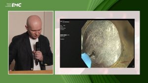 6. Шаповалов А.В, Вакурова Е.С Способы эндоскопического лечения нейромышечных заболеваний пищевода