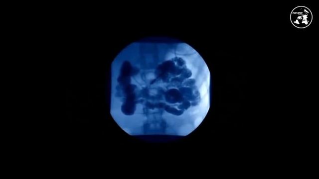 Картофель+помидоры=Смерть твоему Мозгу