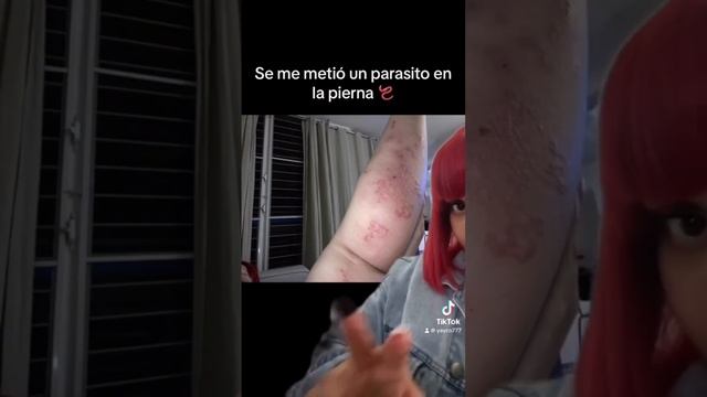 Se me metió un parasito en la pierna 🪱 смотреть онлайн