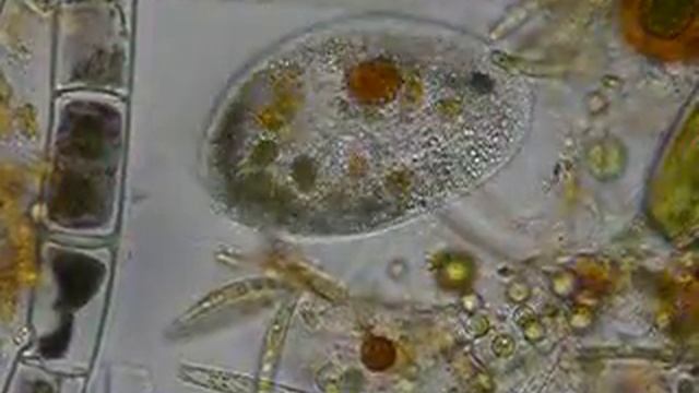 Ciliado Non Identificado (F. Ciliophora)