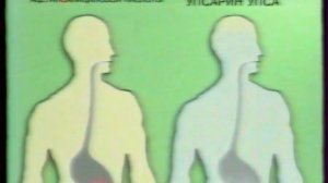 Реклама Упсарин УПСА 2000 (2)