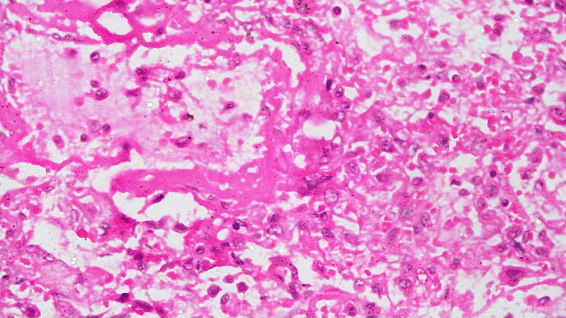 Общая инфектология. ОРВИ смотреть онлайн