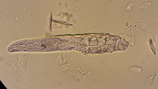 Demodex Mite смотреть онлайн
