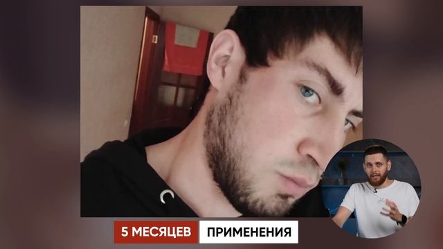 Были волосы на бороде, но хотелось ГУЩЕ / Результаты средств для бороды смотреть онлайн