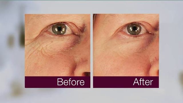 Skin Doctors Gamma Hydroxy смотреть онлайн