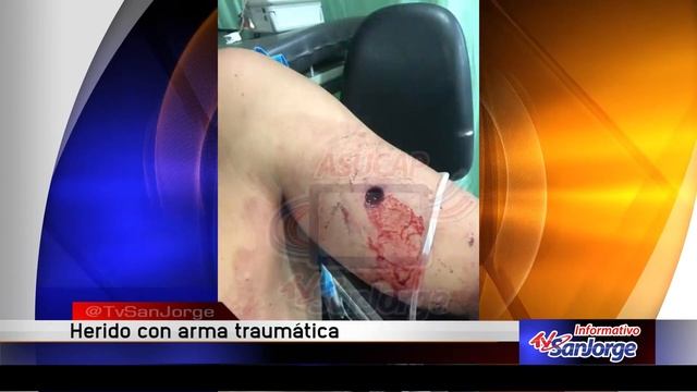 Herido con arma traumática смотреть онлайн