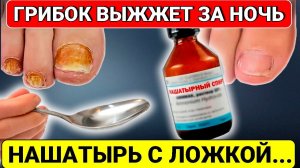 Врач не помог, а ЭТОТ рецепт СПАС мои ногти! Грибок ногтей на ногах