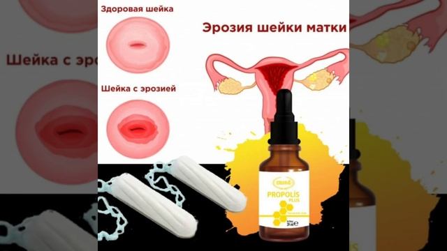 Эрозия смотреть онлайн