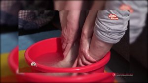 Содовые ванночки для ног? Врач ортопед Литвиненко Андрей Сергеевич в программе «Наш Потреб Надзор»