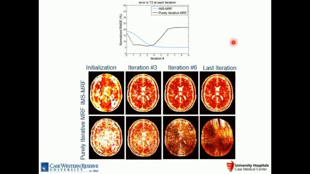 Eric Pierre: Multiscale reconstruction for MR fingerprinting смотреть онлайн