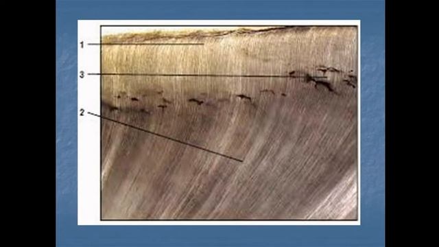 Tish tuzilishi Gistalogiya смотреть онлайн