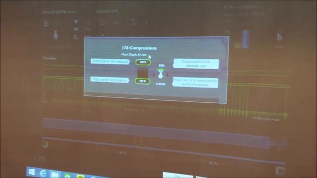 Laerdal Skills Reporter CPR video смотреть онлайн