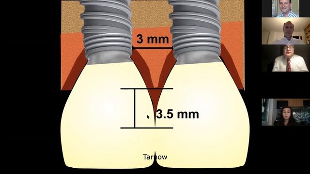 Yumuşak Doku Yumuşak mıdır? Sürüm 10.01 смотреть онлайн