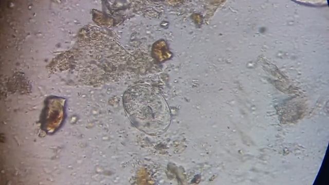 Huevo larvado de Strongyloides spp смотреть онлайн
