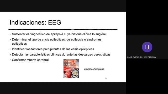 Electroencefalograma, “tips” para el pediatra - 3er. Congreso de pediatría del ISSSTE - SPI смотреть онлайн