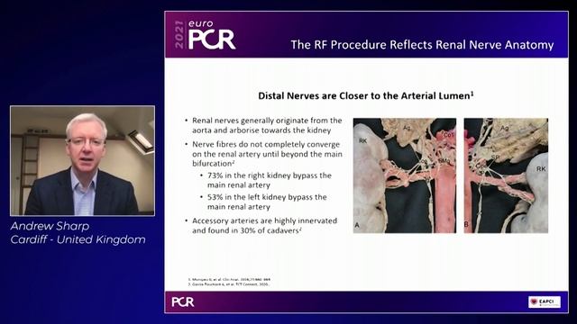 Redefining hypertension management with renal denervation - EuroPCR 2021 смотреть онлайн