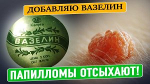 Бородавки и папилломы отпадают после этого средства