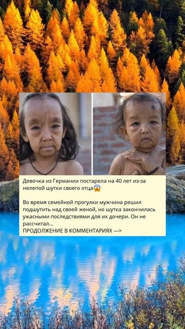 Девочка из Германии постарела на 40 лет из-за нелепой шутки своего отца😱 смотреть онлайн