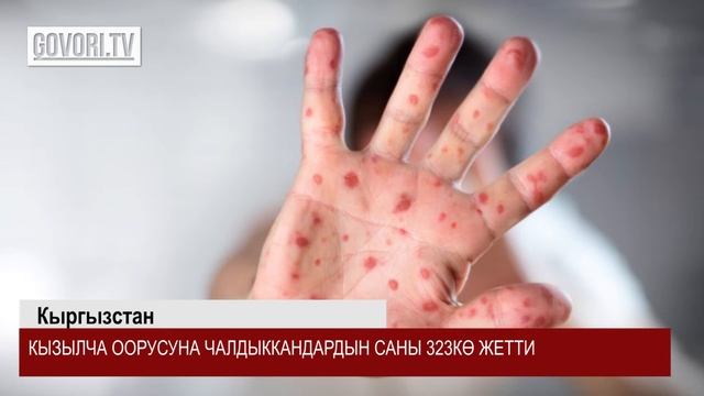 Кыргызстанда кызылча оорусуна чалдыккандардын саны 323кө жетти. Ат-Башыда милиция мас абалында