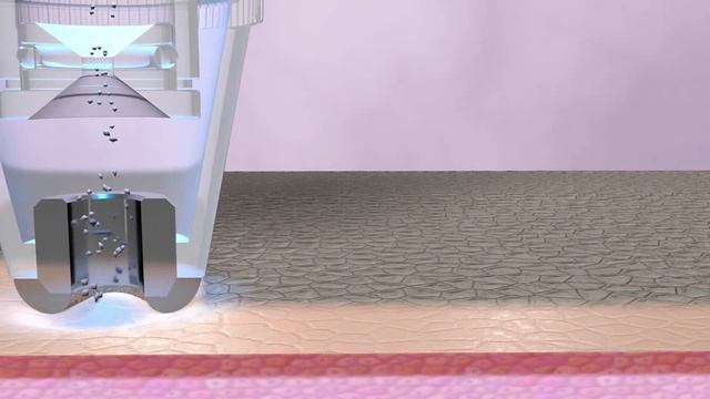 SONIC REFRESHER - Sonic Microdermabrasion System смотреть онлайн