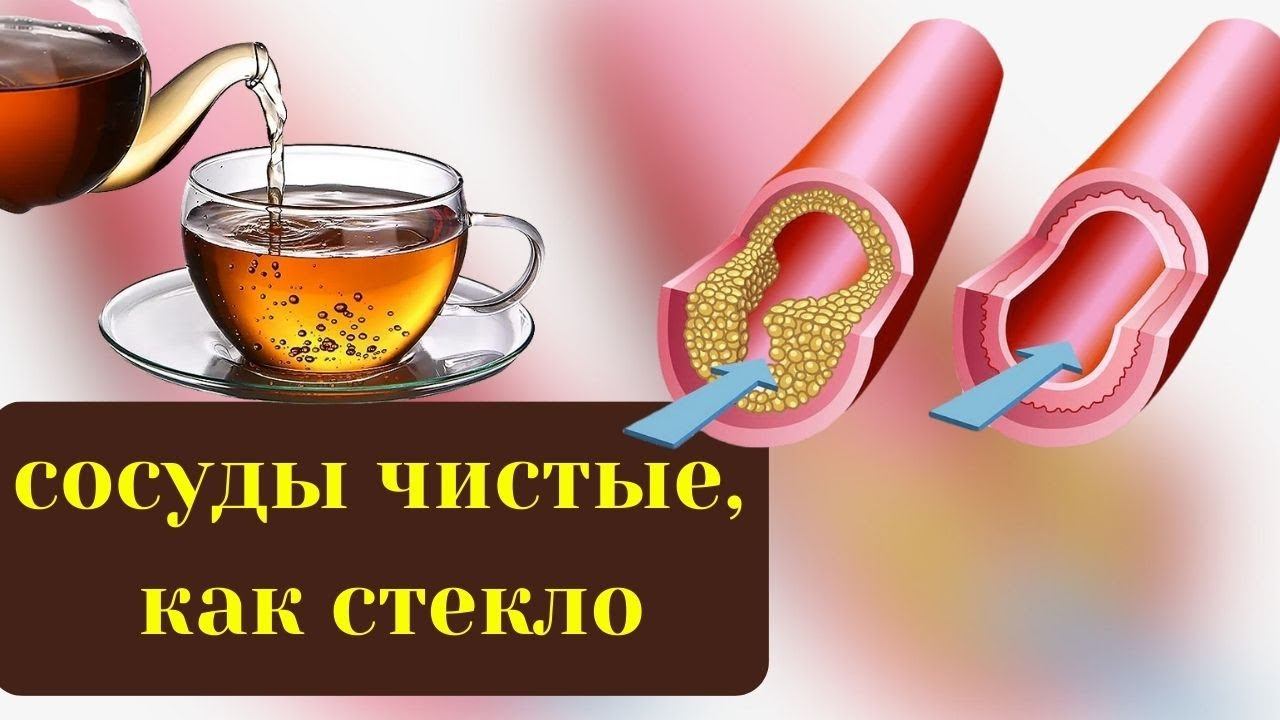 Столько Мучилась, а спас простой...... теперь сосуды, как в 18 лет! смотреть онлайн