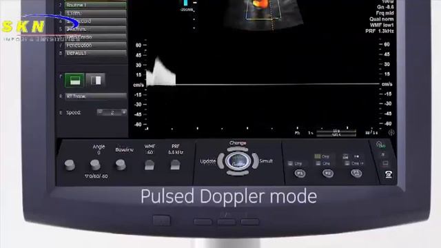 GE Voluson P8 смотреть онлайн