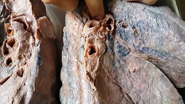Anatomy of Lung | Bangla Demonstration of Lung | Viscera of Lung | Lung Demonstration | Lung Anatom смотреть онлайн