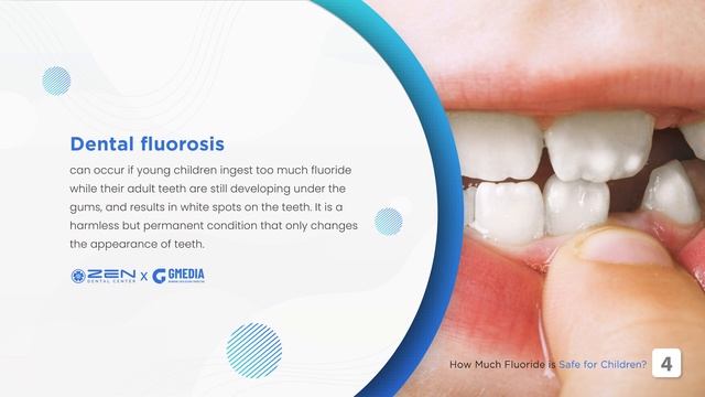 [Zen Dental] Storytelling: How Much Fluoride is Safe for Children?