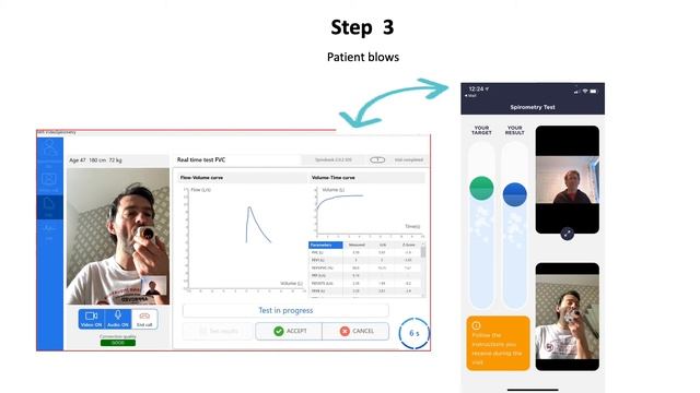 MIR Spirobank Smart Spirometer with SVC enabled смотреть онлайн