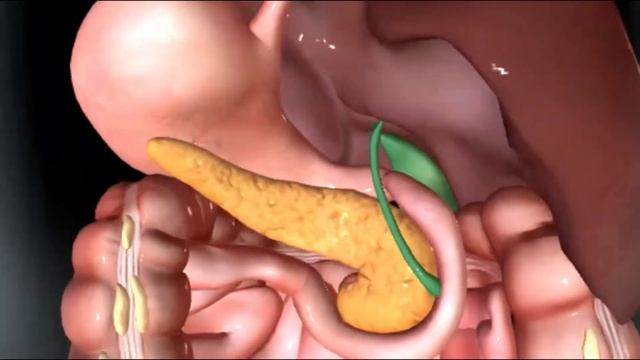 Основные причины панкреатита. Личный опыт.