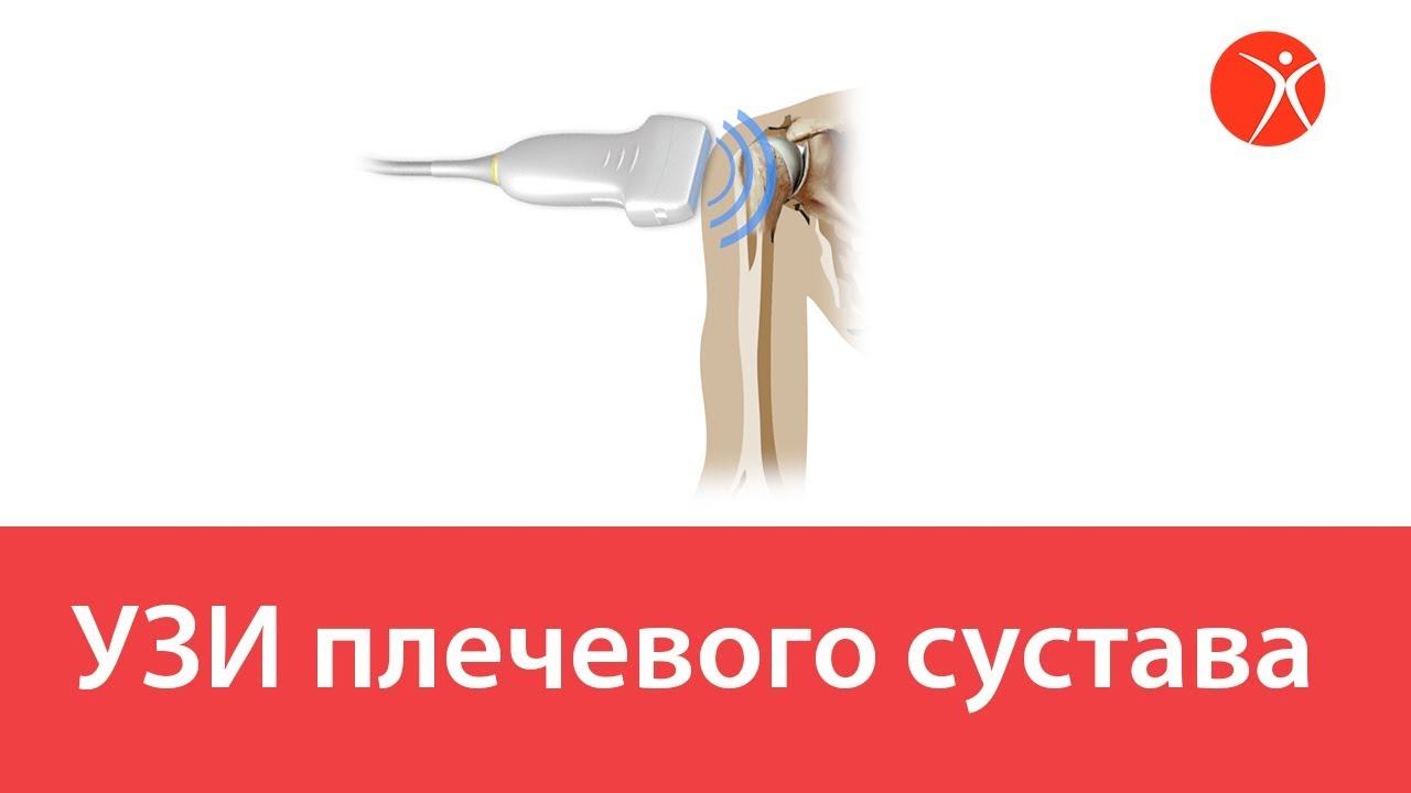 УЗИ плечевого сустава