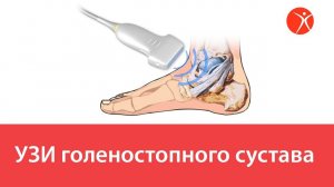 УЗИ голеностопного сустава